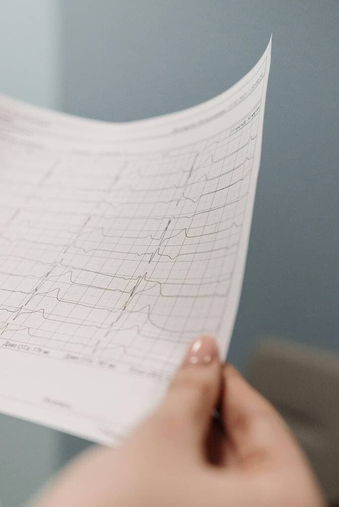 Stylized electrocardiogram heartbeat line on a red and green gradient background